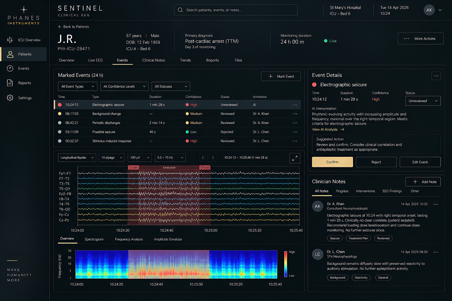 Sentinel concept showing marked EEG events, signal traces and clinician notes